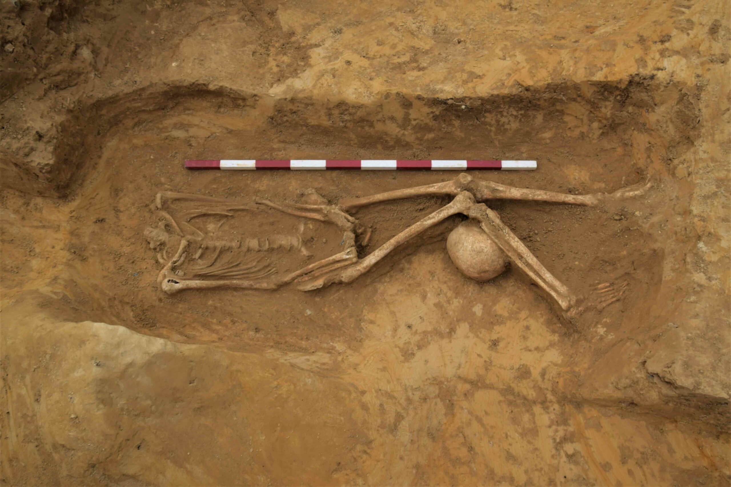 Burials Excavated at Former Mississippi Asylum