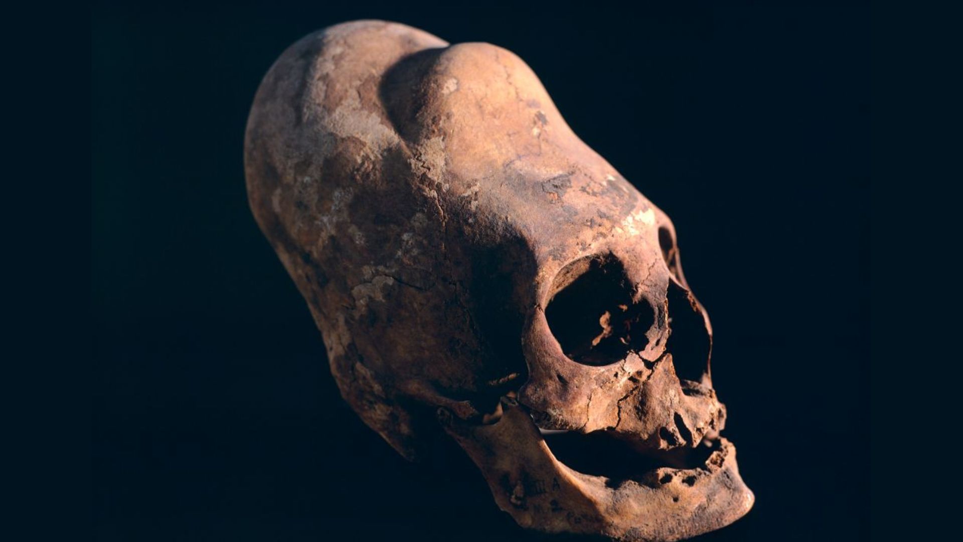 A close up of a brown skull with a conical forehead from head shaping procedures.