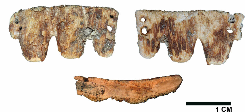 Macro stereomicroscopic images of dental bridge