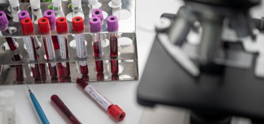 vaccine, biochemistry, mask, negative, patient, plasma, science, 19, chemistry, clinical, diagnosis, exam, experiment, health care, hold, ill, machine, microscope, molecular, nurse, problem, quarantine, result, scientific, gray health, gray science, gray death, gray care, gray chemistry