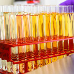 Test z moču by mohol odhaliť rakovinu pľúc ešte pred nástupom príznakov Urine test could help detect lung cancer years before symptoms occur