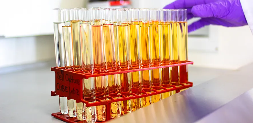 Urine samples