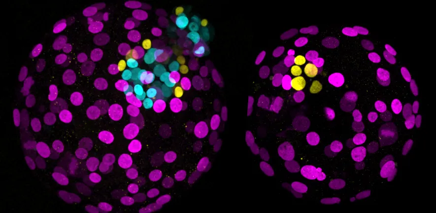Two human embryos, with and without the gene NANOG