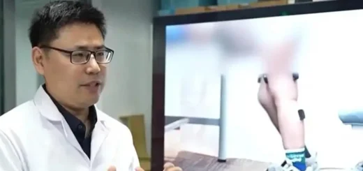 Čínsky nositeľný robot pomohol deťom so spinálnou muskulárnou atrofiou po prvý raz vstať zo stoličky