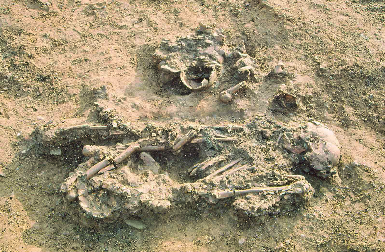 Why Do Some Bones Decay Faster Than Others?