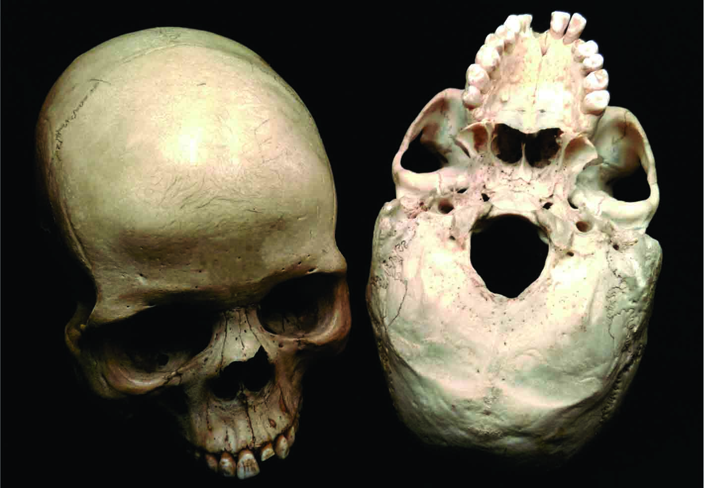 Genetic Material Recovered from 300,000-Year-Old Homo naledi Teeth