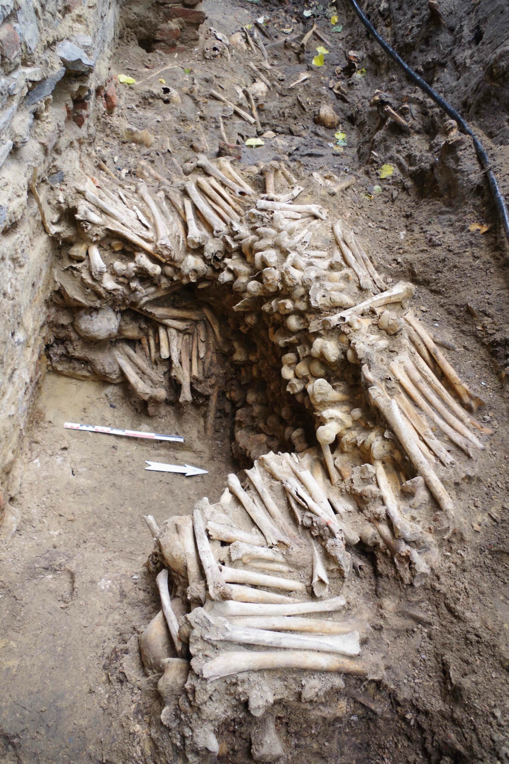 Why Do Some Bones Decay Faster Than Others?