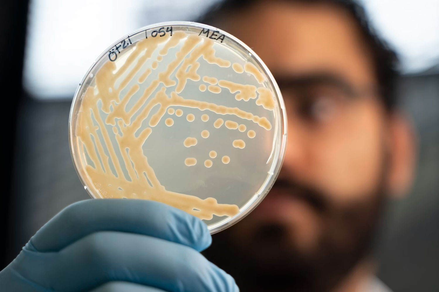 Detail of colonies of yeast taken from a sample of Ötzi’s stomach in a petri dish