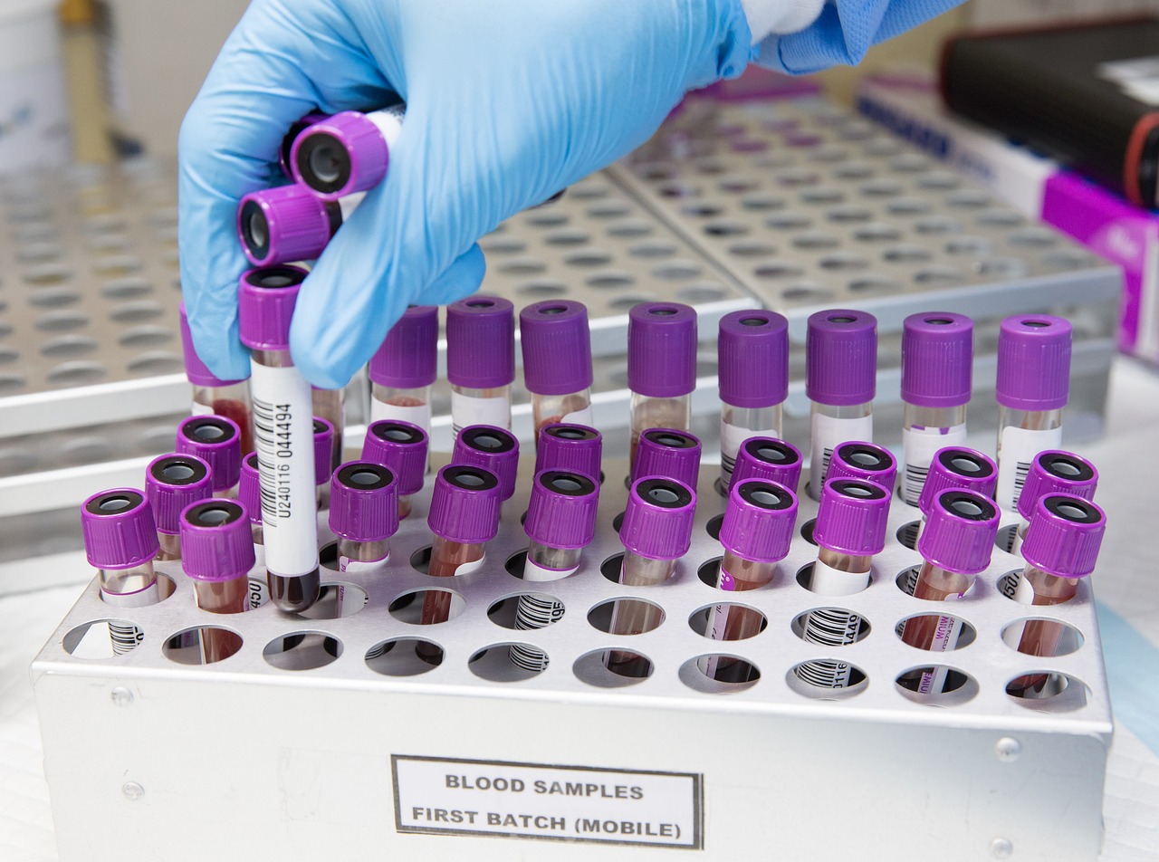 sample, lab, laboratory, scientist, medical, health, test, science, healthcare, research, tube