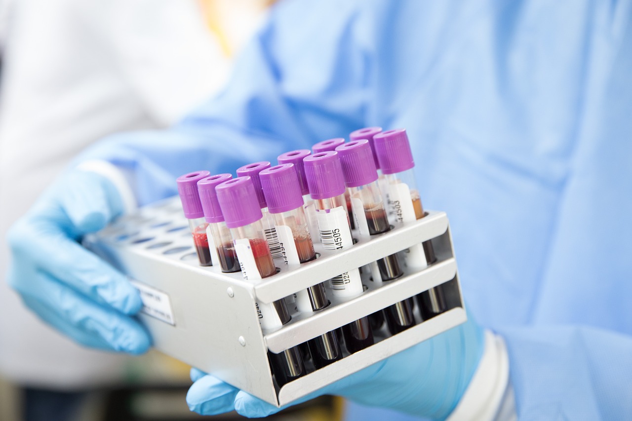 sample, lab, laboratory, scientist, medical, health, test, science, healthcare, research, tube, blue health, blue medical, blue science, blue research, blue lab, blue test, blue blood, blue laboratory, blue healthcare