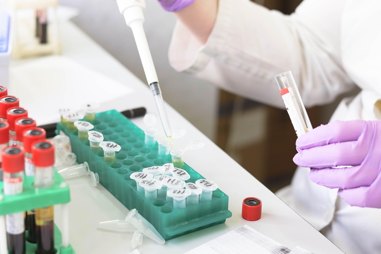 laboratory, medical, medicine, hand, research, lab, test, doctor, equipment, scientist, woman, chemistry, science, hospital, experiment, person, technician, technology, healthcare, working, health, tube, work, research lab, blood samples, laboratory, lab, lab, scientist, scientist, scientist, scientist, scientist