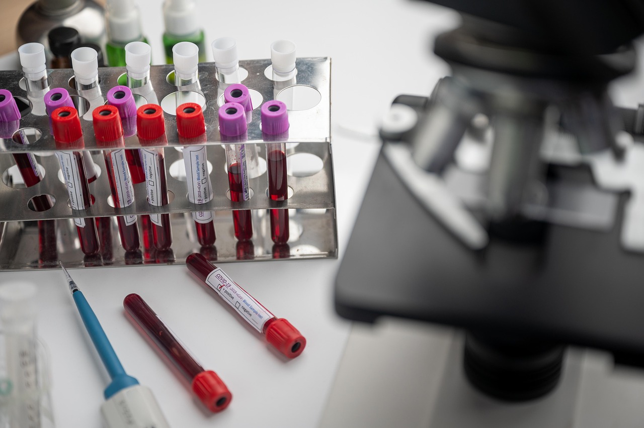 vaccine, biochemistry, mask, negative, patient, plasma, science, 19, chemistry, clinical, diagnosis, exam, experiment, health care, hold, ill, machine, microscope, molecular, nurse, problem, quarantine, result, scientific, gray health, gray science, gray death, gray care, gray chemistry