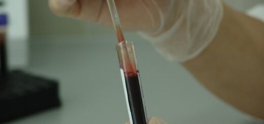vial, analysis, laboratory, test, medical, medicine, science, lab, experiment, health, disease, tube, sample, hospital, scientific, biology, equipment, healthcare, doctor, research, liquid, virus, scientist, illness, cell, biochemistry, pharmaceutical, diagnosis, chemistry, microbiology, specimen, plasma, ampule, cells, biotechnology, immunology, dna, genetic, immune, cancer, aids, treatment, diagnose