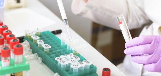 laboratory, medical, medicine, hand, research, lab, test, doctor, equipment, scientist, woman, chemistry, science, hospital, experiment, person, technician, technology, healthcare, working, health, tube, work, research lab, blood samples, laboratory, lab, lab, scientist, scientist, scientist, scientist, scientist