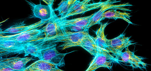 Drobné trubičky v Asgard archaea ponúkajú nové stopy k vzniku zložitého života